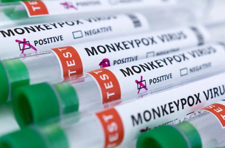 MAYMUN ÇİÇEĞİ HASTALIĞI NEDİR, BELİRTİLERİ NELERDİR?