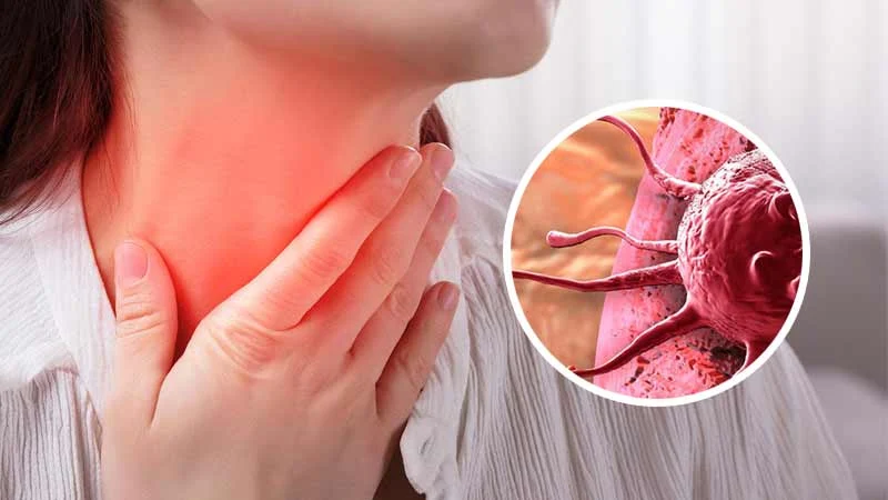 “LENFOMA BELİRTİLERİNE DİKKAT EDİN”