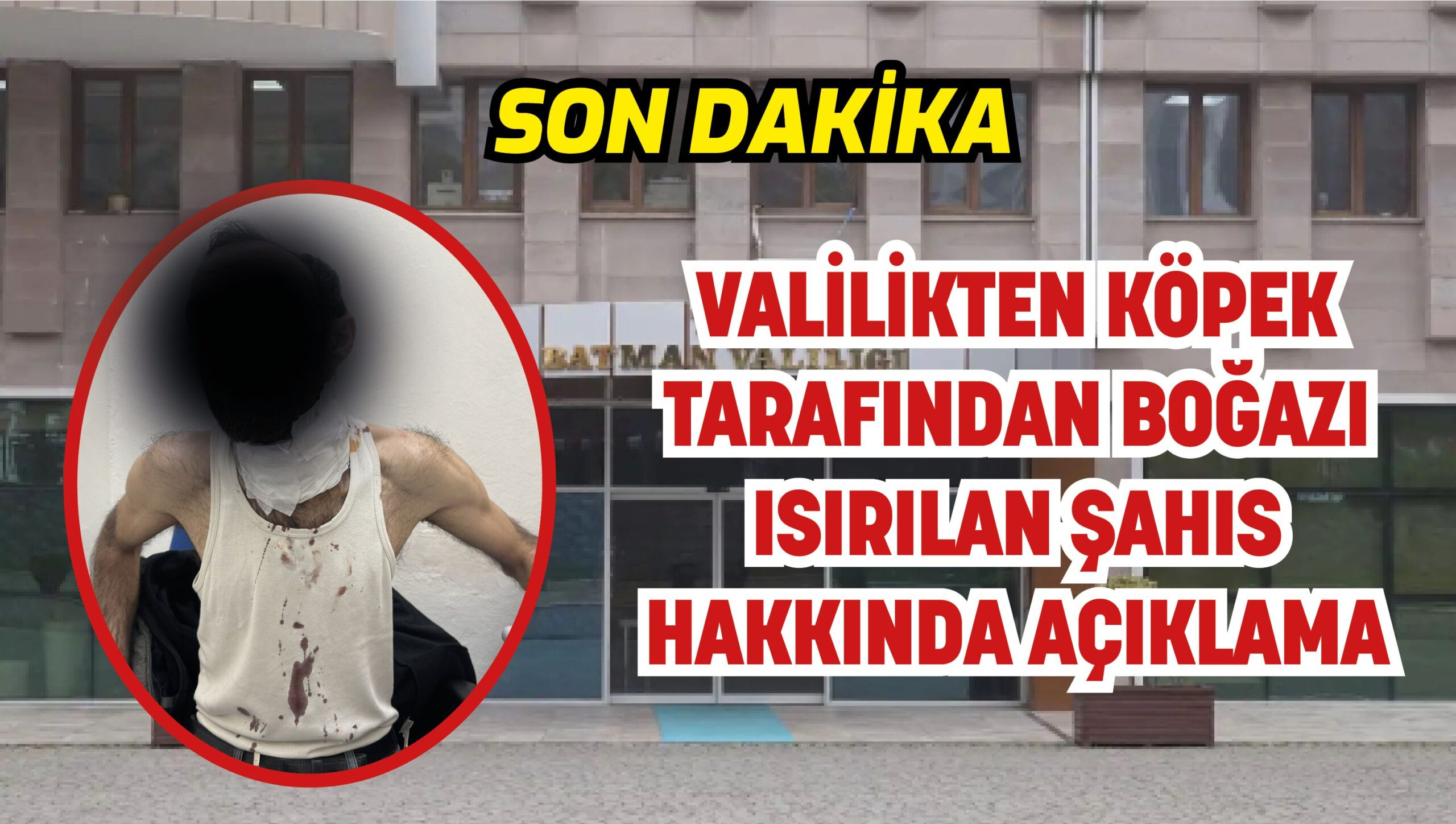 VALİLİKTEN KÖPEK TARAFINDAN BOĞAZI ISIRILAN ŞAHIS HAKKINDA AÇIKLAMA