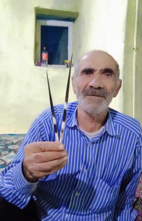 Dağda Yabani Kirpi Saldırısına Uğrayan Vatandaş Şok Geçirdi