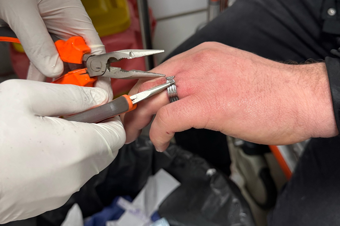 Parmağa Sıkışan Yüzük Hastanede Kesildi