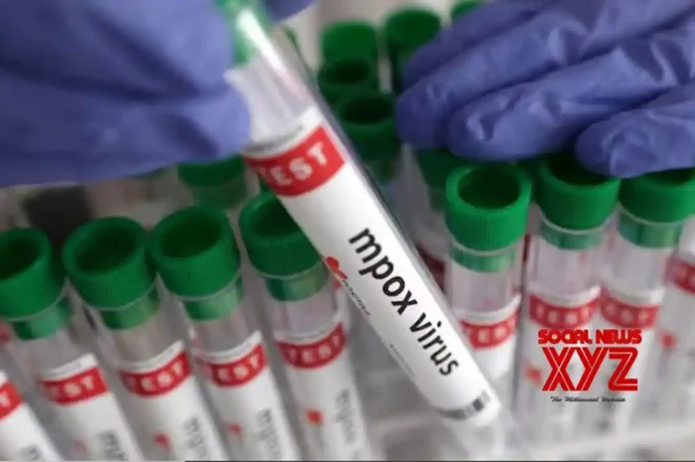 Uganda’da M çiçeği virüsü salgını: 37 ölü