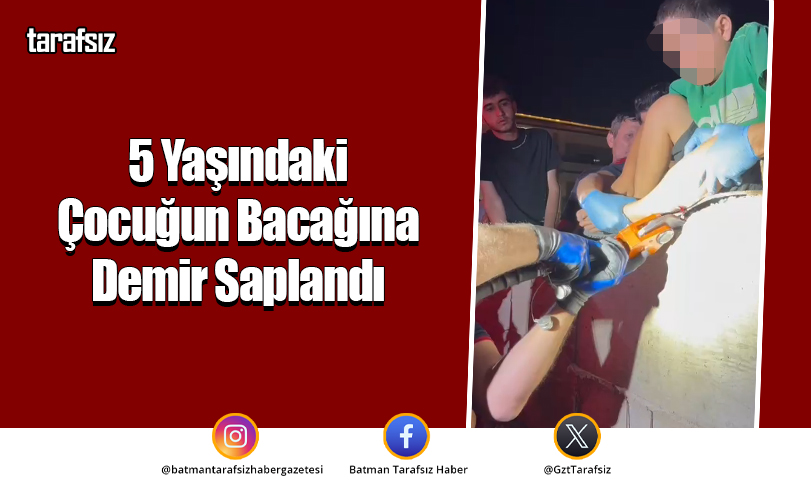 5 Yaşındaki Çocuğun Bacağına Demir Saplandı