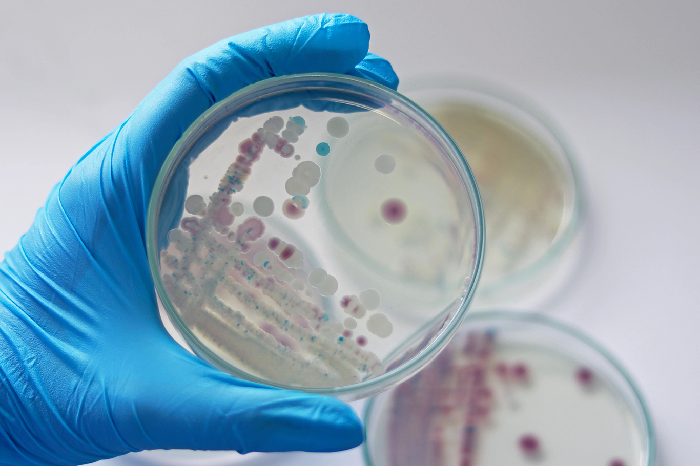 ABD’de Vibrio Alarmı: Can Kayıpları Artıyor