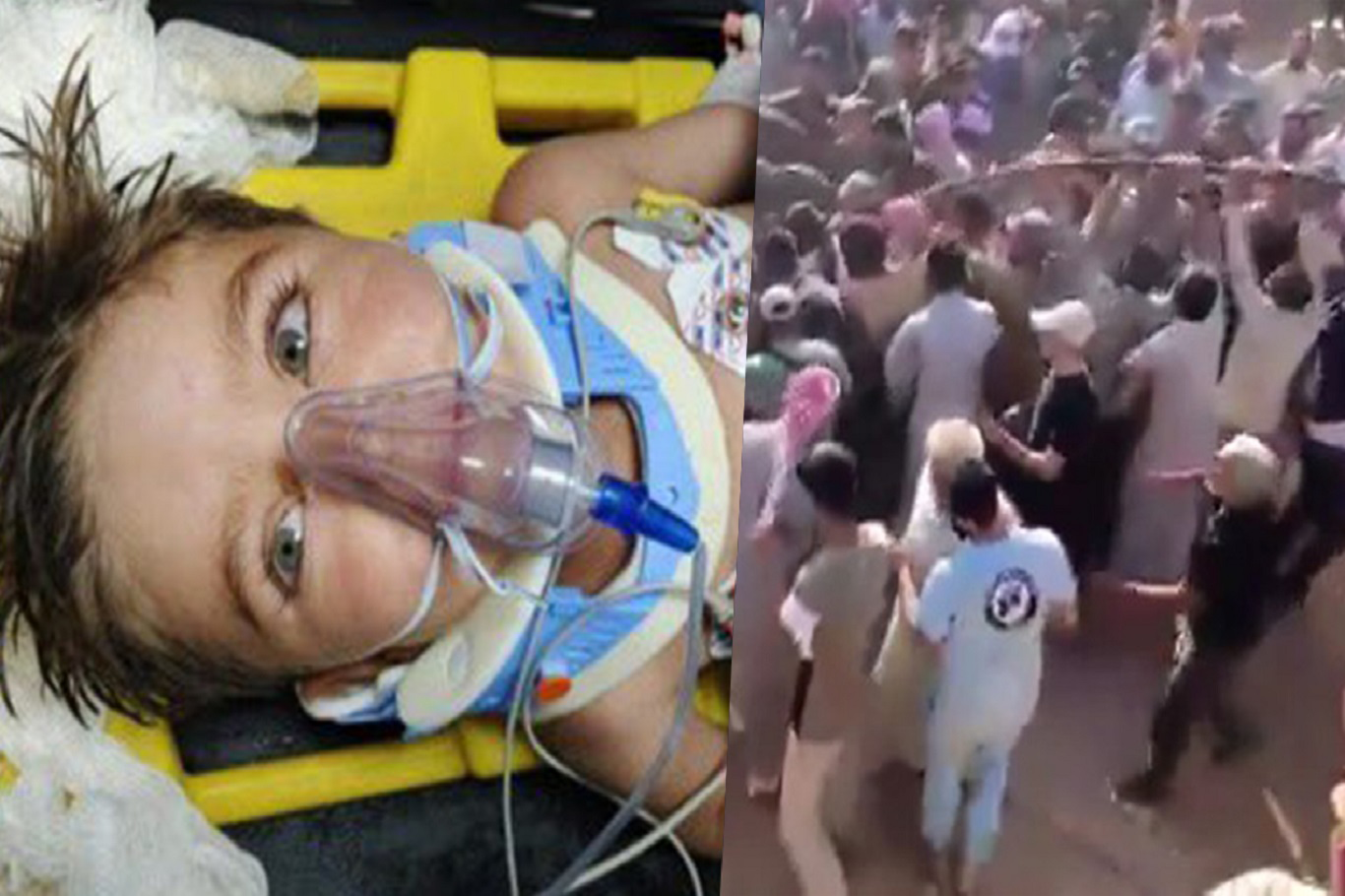 Kuyudan Kurtarılan Suriyeli Çocuk Şanlıurfa’da Tedavi Altında