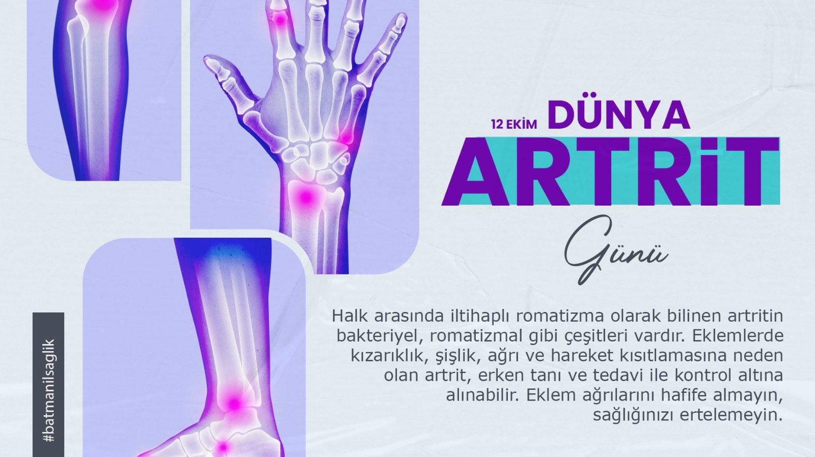 İl Sağlık Müdürlüğü’nden Artrit Farkındalığı Çağrısı