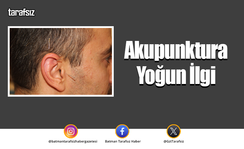 Akupunktura Yoğun İlgi