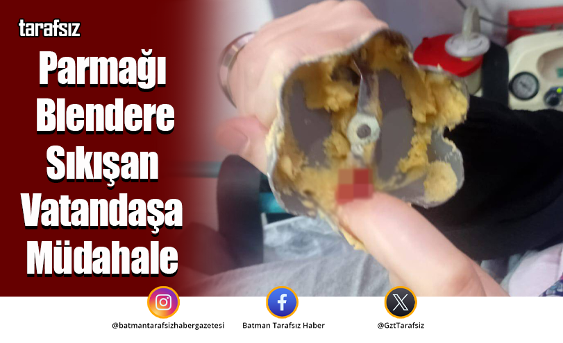Parmağı Blendere Sıkışan Vatandaşa Müdahale