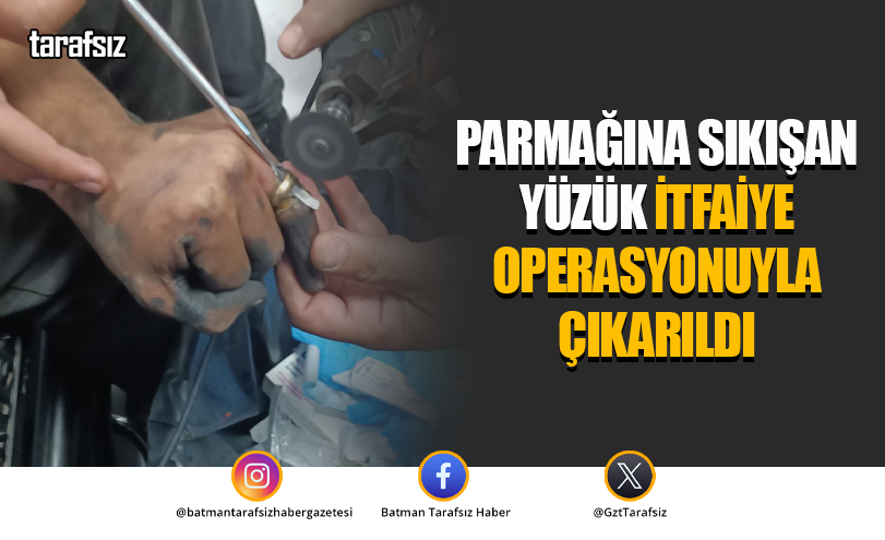Parmağına sıkışan yüzük itfaiye operasyonuyla çıkarıldı