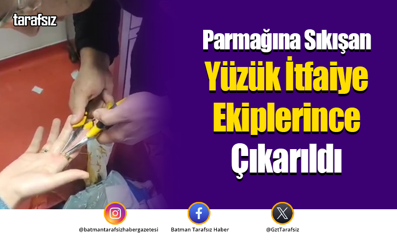 Parmağına Sıkışan Yüzük İtfaiye Ekiplerince Çıkarıldı