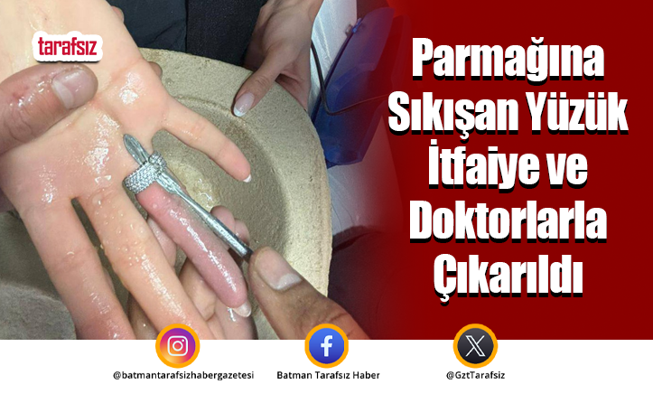 Parmağına Sıkışan Yüzük İtfaiye ve Doktorlarla Çıkarıldı