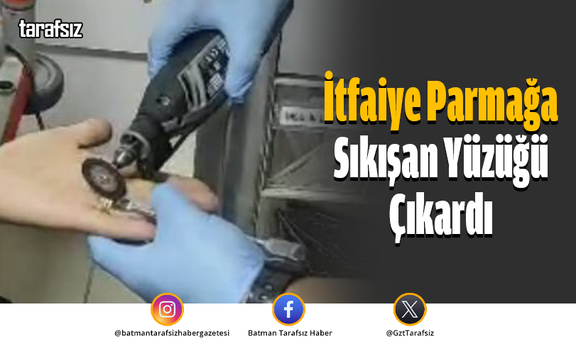 İtfaiye Parmağa Sıkışan Yüzüğü Çıkardı