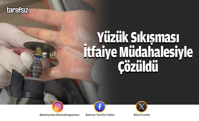 Yüzük Sıkışması İtfaiye Müdahalesiyle Çözüldü