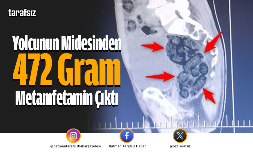 Yolcunun Midesinden 472 Gram Metamfetamin Çıktı