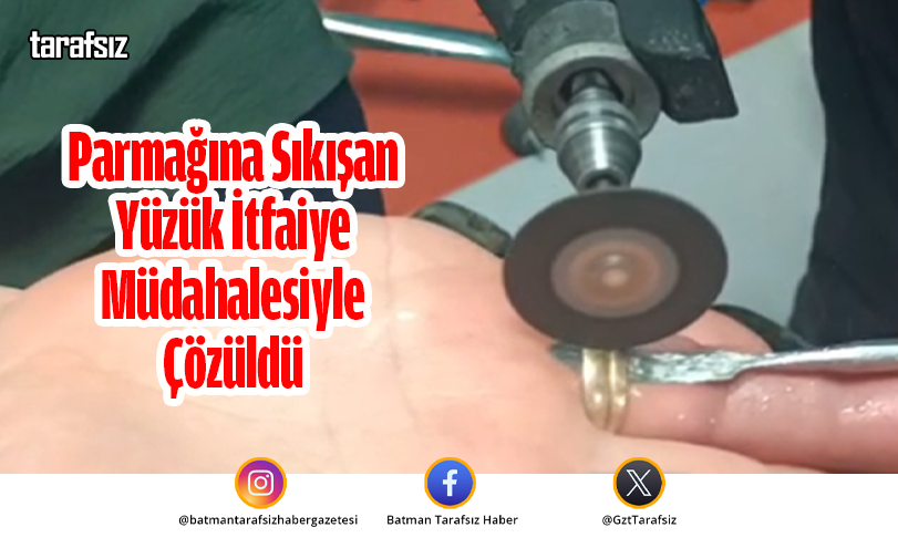 Parmağına Sıkışan Yüzük İtfaiye Müdahalesiyle Çözüldü