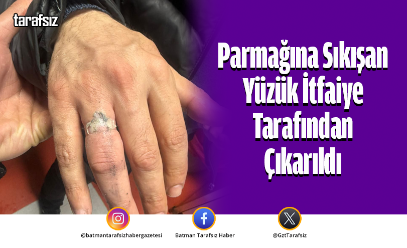 Parmağına Sıkışan Yüzük İtfaiye Tarafından Çıkarıldı