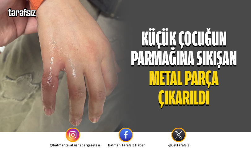 Küçük Çocuğun Parmağına Sıkışan Metal Parça Çıkarıldı