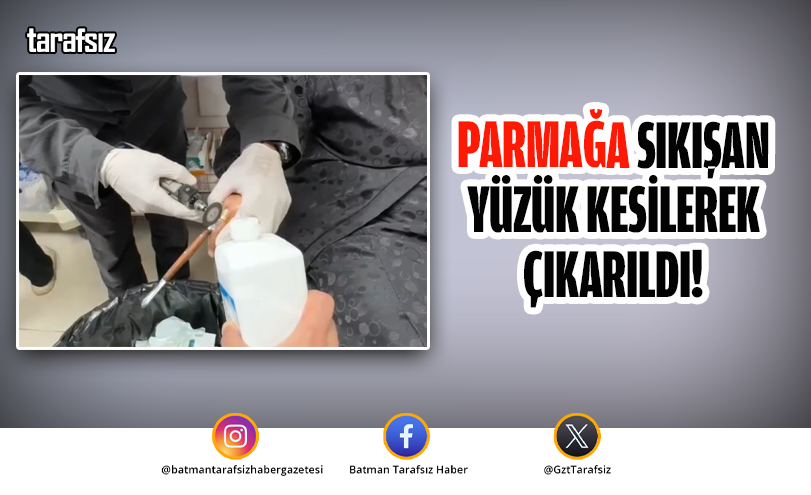 PARMAĞA SIKIŞAN YÜZÜK KESİLEREK ÇIKARILDI!