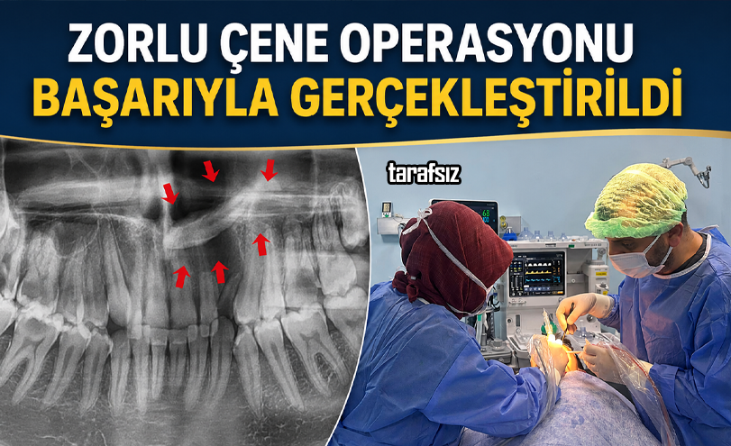 Zorlu Çene Operasyonu Başarıyla Gerçekleştirildi