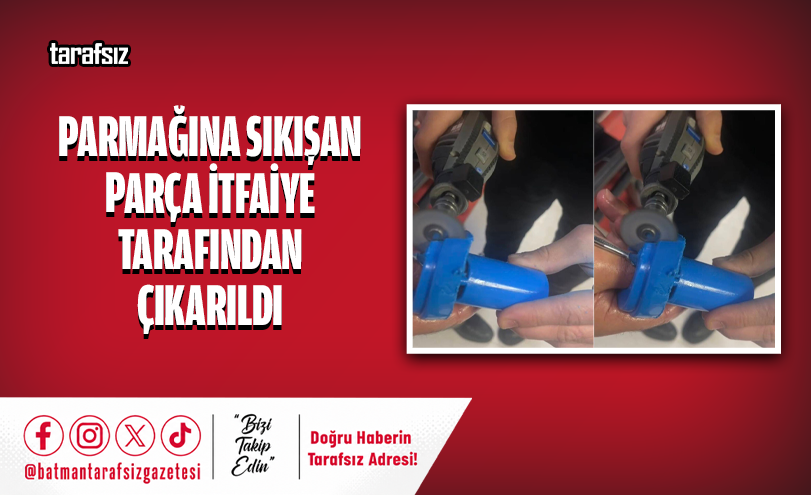 Parmağına Sıkışan Parça İtfaiye Tarafından Çıkarıldı