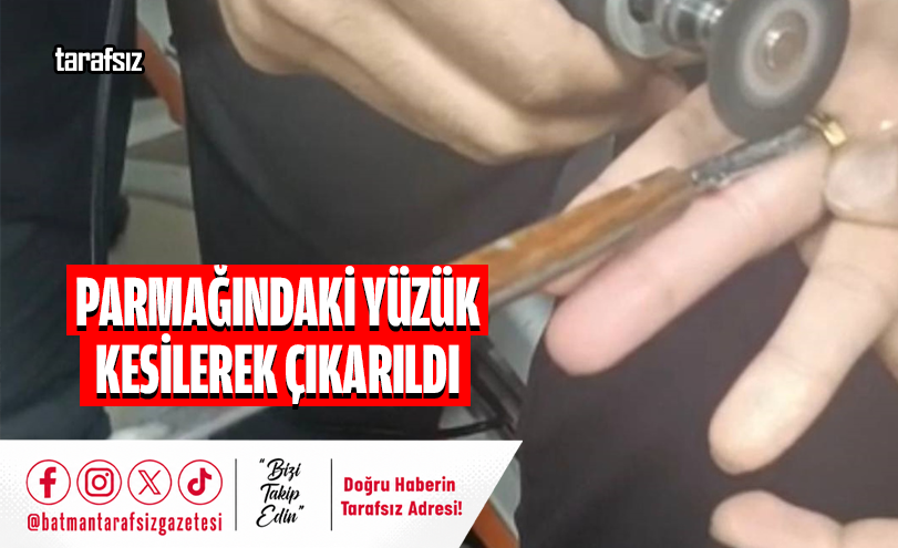 Parmağındaki Yüzük Kesilerek Çıkarıldı