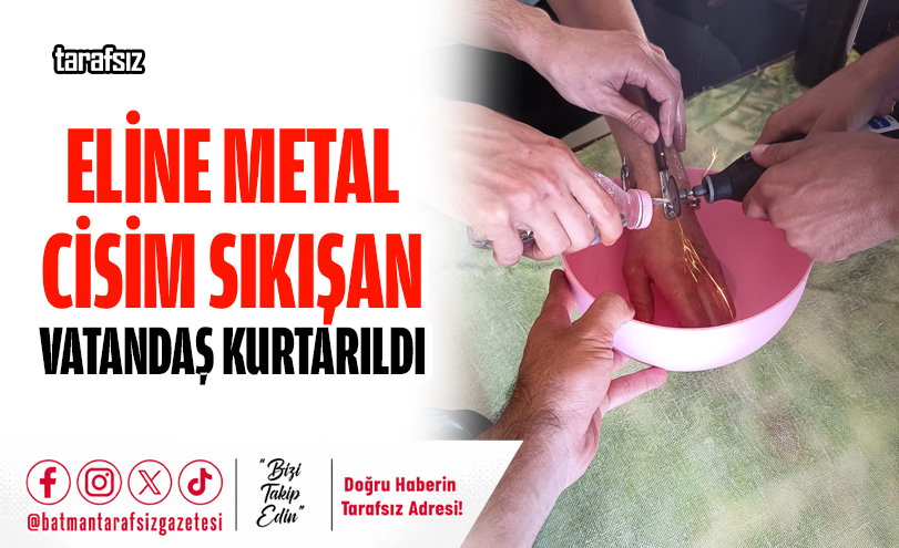 Eline Metal Cisim Sıkışan Vatandaş Kurtarıldı