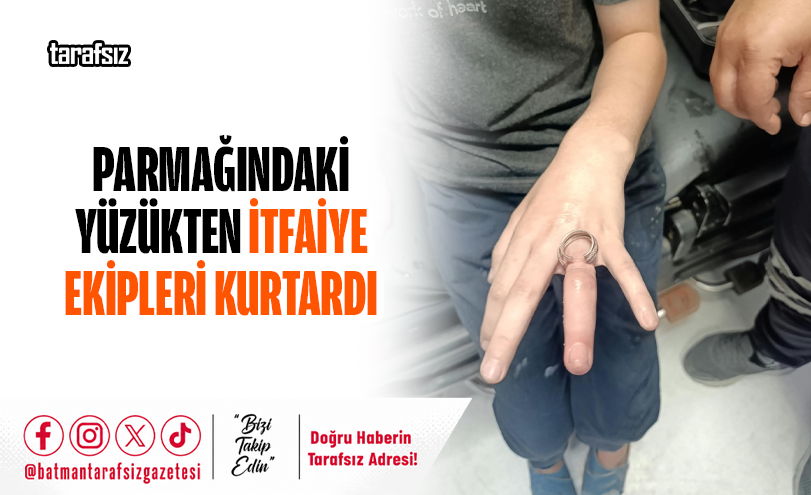 Parmağındaki Yüzükten İtfaiye Ekipleri Kurtardı
