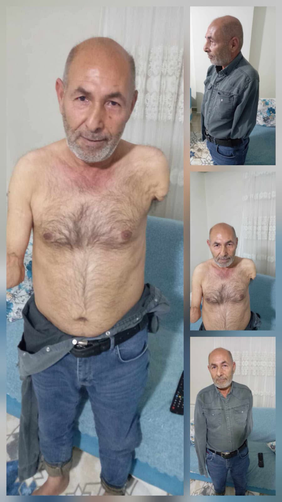 İKİ KOLU YOK, AMA “TAM BAĞIMLI” DEĞİL!